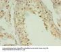 ACBD4 Antibody