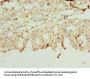 NETO2 Antibody