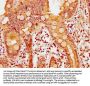 APPL2 Antibody