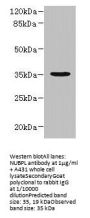 NUBPL Antibody