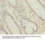 NUBPL Antibody