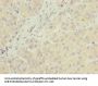 NUBPL Antibody