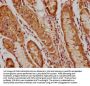 PIP4K2C Antibody