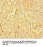 LRRC15 Antibody