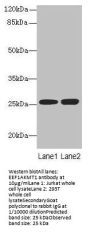 EEF1AKMT1 Antibody