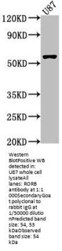 RORB Antibody