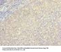 BORCS5 Antibody
