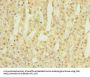 BORCS5 Antibody