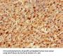 TP53INP1 Antibody
