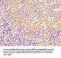PBK Antibody