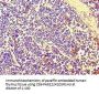 PBK Antibody