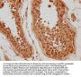 WDR92 Antibody