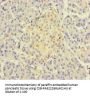 TSNARE1 Antibody