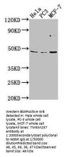 TMEM237 Antibody