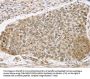 SMARCA2 Antibody