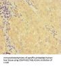 KDM1B Antibody
