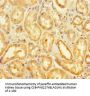 KDM1B Antibody