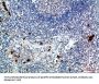 ZAP70 Antibody