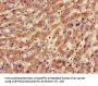 BBS10 Antibody