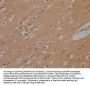 PLPPR1 Antibody