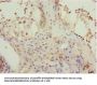 KBTBD7 Antibody