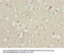 KBTBD7 Antibody
