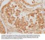 KBTBD7 Antibody