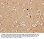 KBTBD7 Antibody