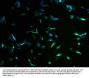 KBTBD7 Antibody