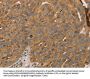 PARP11 Antibody