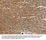PARP11 Antibody