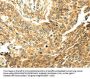 SERPINA12 Antibody