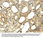 SERPINA12 Antibody