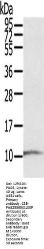 S100P Antibody