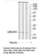 UBE2D2 Antibody