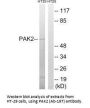 PAK2 (Ab-197) Antibody