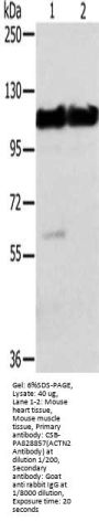 ACTN2 Antibody