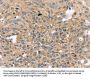RASGEF1A Antibody