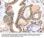RASGEF1A Antibody
