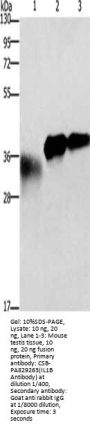 IL1B Antibody