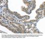 VLDLR Antibody