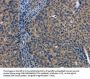 LATS1 Antibody
