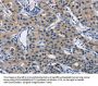 LATS1 Antibody