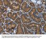 SNCG Antibody