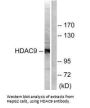 HDAC9 Antibody