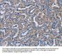 NCR2 Antibody