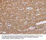 NCR2 Antibody