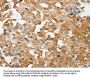 SESN2 Antibody