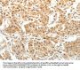 PTPRE Antibody