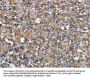 CEACAM6 Antibody